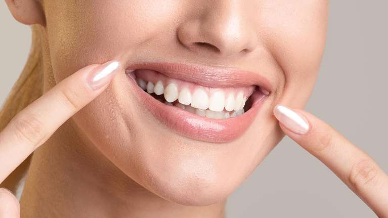 brandon woman pointing to bright smile after veneers